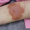 박소영한의원 이미지