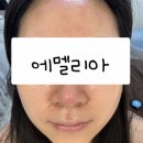 에멜리아(EMELIA) | 평택 피부관리 에멜리아 | 최첨단 장비와 피부과 실장 경력 원장님의 콜라보~