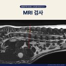 서초M동물의료센터 | 부산 해운대 강아지 디스크 양방향 척추내시경수술 후기, 24시외과동물병원