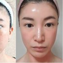 인셀덤처인구