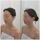 에이원 | 구미웨딩관리 산동웨딩관리 에이원뷰티 솔직후기