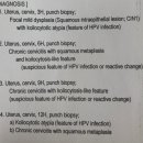 (주)노도시스 | 자궁경부암 조직검사 결과 - 이형성증 1단계(CIN1) 11.23