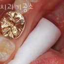 다온치과기공소 이미지