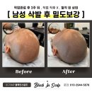 도트인스칼프