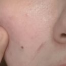 홍대예쁨주의쁨의원 이미지