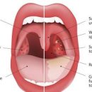 만성 급성 편도염 증상 원인 치료 이미지