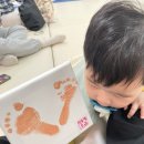 에스앤유서울병원 | 9개월 짚고서기 시작했어요, 이소성몽고반점, 에스앤유피부과, 카페명당, 안양예술공원, 미스터리브루잉...