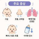아기 모세기관지염 어린이집 등원 가능할까?｜기침·쌕쌕거림 현실 후기