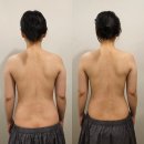 위드케어 | 방배동림프순환관리 위드에스테틱 등 면역케어후기