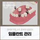 사하구-56 | 부산 사하구치과 어금니 임플란트 후기 찾기 전 알아야 할 관리