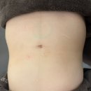 엠케이톡 | 성신여대에스테틱 엠케이에스테틱에서 복부집중 파워슬리밍 관리로 라인까지 정리된 후기