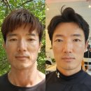 김현이피부관리