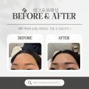 리그로브 왁싱(Regorve waxing) | 대구 감삼동 헤어라인왁싱 추천┃리그로브왁싱