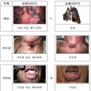 그림문구