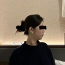 팽팽의원 | 팽팽의원에서 실리프팅 받은 후기(2주차효과, 통증, 가격)