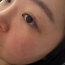 주식회사 부안클린케어 | 엑소좀 세럼 추천, 모공케어와 피부결관리 한 번에 끝낸 후기