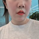 썬SUN 에스테틱