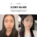 예가헤어 - 아산시 모종동 | 대전 경락 추천 | 작은얼굴관리, 신부관리로 유명한 도인예가 에스테틱 솔직후기