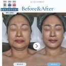 선 피부앤바디 이미지