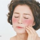 홍조