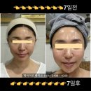 소사탕후루 | 유니앤코어 비타민C 탕후루팩 내돈내산 후기 피부광채 효과 직접 써본 리얼 리뷰(+가격)