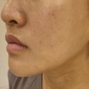 안청남로-2 | 창원피부관리 문제성관리 솔직후기 혜리온에스테틱