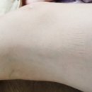 복현정형외과의원 네이버블로그