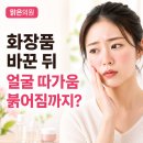 최윤정피부과의원 네이버블로그