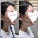 탱샵 | [개 어멈] 호평동 마사지 탱샵에서 얼굴 부기와 1회...독소 배출 마사지 솔직 리얼 내 돈 내산 찐 후기