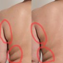 [간석동 피부관리]힐링뷰티샵| 림프순환마사지 솔직후기