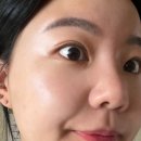 주식회사 메디라인 | 문제성피부 여드름연고 추천 울긋불긋한 피부 고민 &#39;히루스카 클리어&amp;아크네&#39;로 해결해요