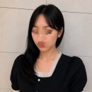 선피부과의원 | 신논현역 피부과의원 셰르프 300샷 전후 후기, 시술대상, 셰르프 당일 통증, 일주일 후기