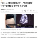 수술실 CCTV 없는데 ????? 어쩔건데 ?????? 이미지