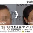 모재성성형외과의원 이미지