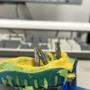 보일치과기공소 이미지