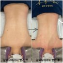 오토오아시스일곡점 | [광주] 광주 북구 에스테틱 에끌라영 에스테틱 알포유 에너지 테라피 솔직후기