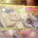 이리옴프라자 이미지