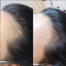 송' S 헤어라인
