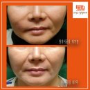 고익수성형외과의원 이미지