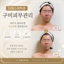 여헌로-3 | 구미피부관리 더에스테틱온 작은얼굴관리 얼굴라인 케어 후기