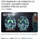 뿅뿅김밥 이미지