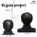 리게인프로젝트 일산 이미지