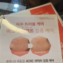 부영2차(아)경로당 | 서울 최저가 스킨플래닝 이벤트 진행중인 세레니끄 목동점- 스킨플래닝 주기 및 가격 효과 후기