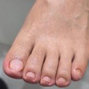 탱스네일 | 남양주 내성발톱과 무좀 발각질까지 해결! 탱스네일&오로지푸스 맞춤깔창 후기