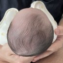 이을아이두의원 네이버블로그