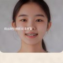 미소라인 네이버블로그