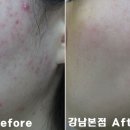 리유한의원 네이버블로그
