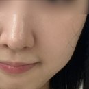 세븐일레븐(의왕내손제일점) | 의왕피부관리 코블랙헤드 고민 없애러 더맑은스킨 의왕내손점 모공디톡스 재방문 후기