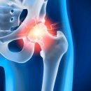 삼성본정형외과의원 이미지