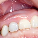 단디치과의원 | 이가 시릴 때마다 드는 생각의 무게